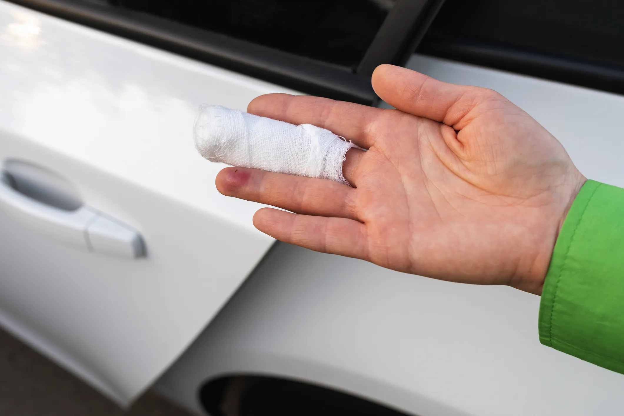 car door injuries