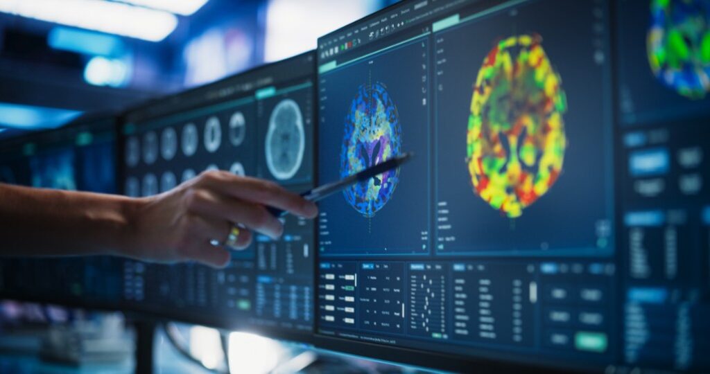 Chicago brain injury lawyer