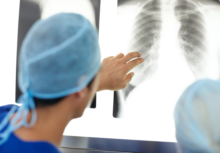 doctor analyzing rib injury X-ray - How much compensation is possible after bruised ribs in a car accident?